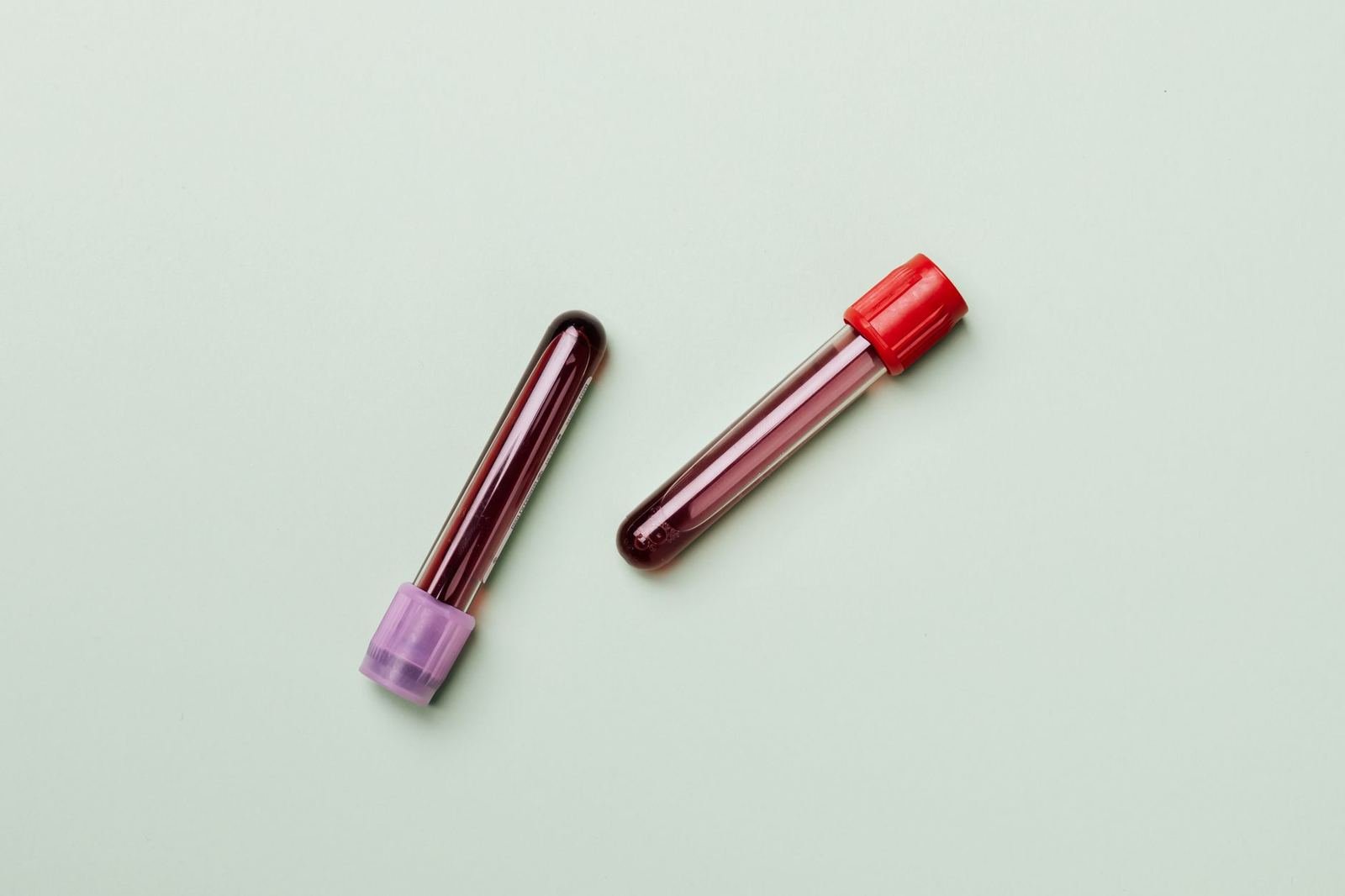 Dos tubos de muestra de sangre con tapas morada y roja sobre un fondo verde claro, sin personas ni texto