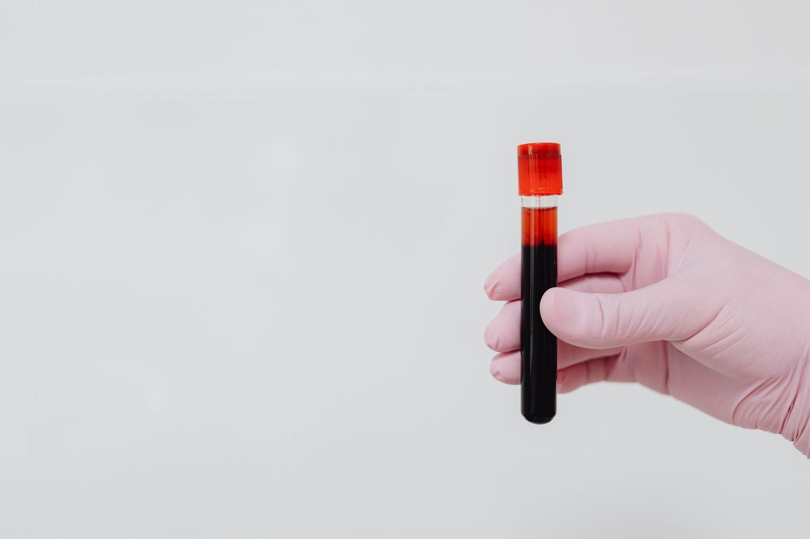 Mano con guante rosa sostiene un tubo de ensayo con una muestra de sangre sobre un fondo claro, sin rostro ni texto