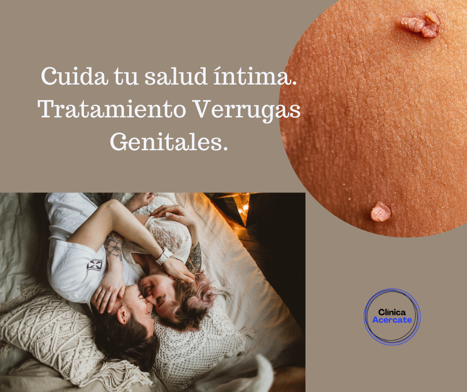 Como quitar verrugas genitales